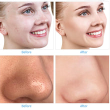 Load image into Gallery viewer, Crysella Pore Polish Diamond Microdermabrasion Facial Cleansing Device
