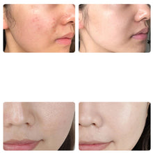 Load image into Gallery viewer, GlowVita LED Light Therapy Face Mask